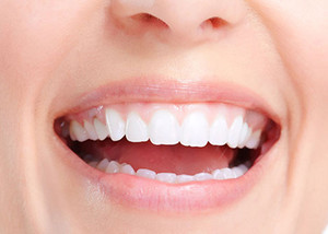 Imagen de Diseño de Encías